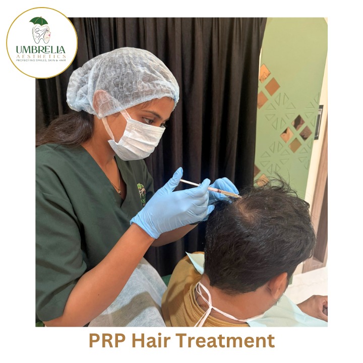 PRP treatment at Umbrella Aesthetics hair clinic in Mysore